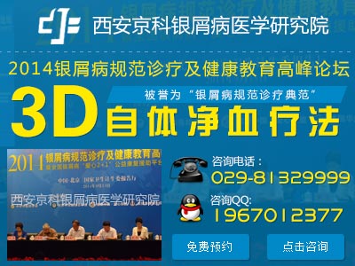 牛皮癣的最新治疗方法