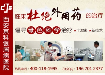 郑州牛皮癣重点医院