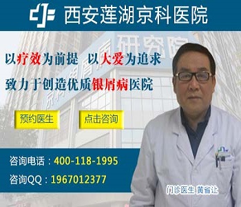 郑州市银屑病中医治疗医院